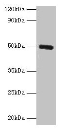 CLEC18A Antibody - Western blot All lanes: C-type lectin domain family 18 member A antibody at 2µg/ml + Mouse stomach tissue Secondary Goat polyclonal to Ribbit lgG at 1/10000 dilution Predicted band size: 50, 12 kDa Observed band size: 50 kDa