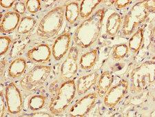 CLEC18A Antibody - Immunohistochemistry of paraffin-embedded human kidney tissue using CLEC18A Antibody at dilution of 1:100