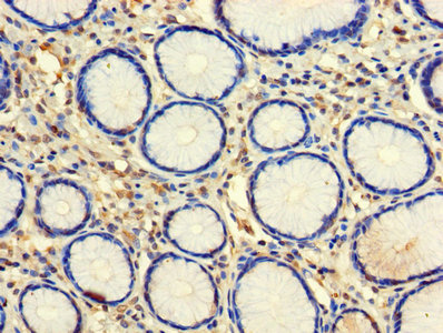 CLEC18A Antibody - Immunohistochemistry of paraffin-embedded human stomach tissue using CLEC18A Antibody at dilution of 1:100