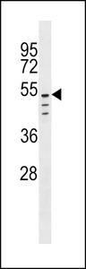 CLEC18C Antibody - CLEC18C Antibody western blot of A2058 cell line lysates (35 ug/lane). The CLEC18C antibody detected the CLEC18C protein (arrow).