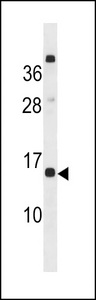 CLEC19A Antibody - CLEC19A Antibody western blot of MCF-7 cell line lysates (35 ug/lane). The CLEC19A antibody detected the CLEC19A protein (arrow).