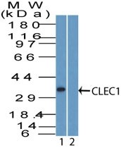 CLEC1A / CLEC-1 Antibody - Western Blot: CLEC1A Antibody - analysis of CLEC1 using CLEC1 antibody. Human lung tissue lysate in the 1) absence and 2) presence of immunizing peptide probed with 2 ug/ml of CLEC1 antibody. goat anti-rabbit Ig HRP secondary antibody and PicoTect ECL substrate solution were used for this test.
