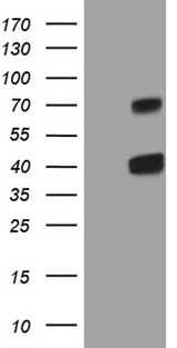 CLEC1A / CLEC-1 Antibody - HEK293T cells were transfected with the pCMV6-ENTRY control. (Left lane) or pCMV6-ENTRY CLEC1A. (Right lane) cDNA for 48 hrs and lysed. Equivalent amounts of cell lysates. (5 ug per lane) were separated by SDS-PAGE and immunoblotted with anti-CLEC1A. (1:2000)