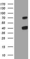 CLEC1A / CLEC-1 Antibody - HEK293T cells were transfected with the pCMV6-ENTRY control. (Left lane) or pCMV6-ENTRY CLEC1A. (Right lane) cDNA for 48 hrs and lysed. Equivalent amounts of cell lysates. (5 ug per lane) were separated by SDS-PAGE and immunoblotted with anti-CLEC1A. (1:2000)