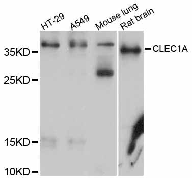 CLEC1A / CLEC-1 Antibody - Western blot analysis of extracts of various cell lines, using CLEC1A antibody at 1:1000 dilution. The secondary antibody used was an HRP Goat Anti-Rabbit IgG (H+L) at 1:10000 dilution. Lysates were loaded 25ug per lane and 3% nonfat dry milk in TBST was used for blocking. An ECL Kit was used for detection and the exposure time was 90s.