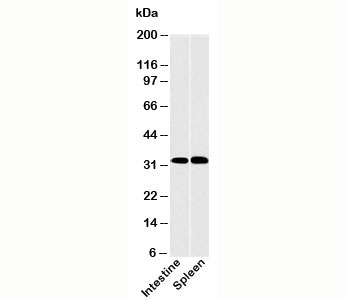 CLEC1A / CLEC-1 Antibody - CLEC1 antibody western blot of human samples