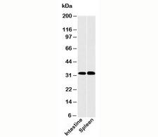CLEC1A / CLEC-1 Antibody - CLEC1 antibody western blot of human samples