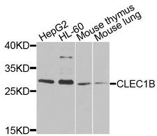 CLEC1B / CLEC-2 Antibody - Western blot analysis of extracts of various cells.