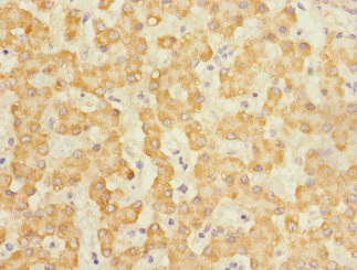 CLEC1B / CLEC-2 Antibody - Immunohistochemistry of paraffin-embedded human liver tissue at dilution 1:100