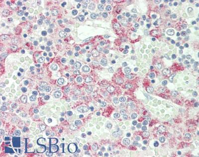 CLEC1B / CLEC-2 Antibody - Human Liver: Formalin-Fixed, Paraffin-Embedded (FFPE).  This image was taken for the unconjugated form of this product. Other forms have not been tested.