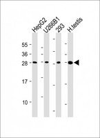 CLEC1B / CLEC-2 Antibody - All lanes: Anti-CLEC1B Antibody (N-Term) at dilution Lane 1: HepG2 whole cell lysate Lane 2: U266B1 whole cell lysate Lane 3: 293 whole cell lysate Lane 4: Human testis lysate Lysates/proteins at 20 µg per lane. Secondary Goat Anti-Rabbit IgG, (H+L), Peroxidase conjugated at 1/10000 dilution. Predicted band size: 27kDa Blocking/Dilution buffer: 5% NFDM/TBST.