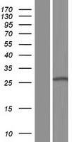 CLEC1B / CLEC-2 Protein - Western validation with an anti-DDK antibody * L: Control HEK293 lysate R: Over-expression lysate