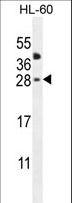 CLEC2A Antibody - CLEC2A Antibody western blot of HL-60 cell line lysates (35 ug/lane). The CLEC2A antibody detected the CLEC2A protein (arrow).