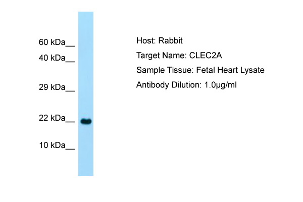 CLEC2A Antibody -  This image was taken for the unconjugated form of this product. Other forms have not been tested.