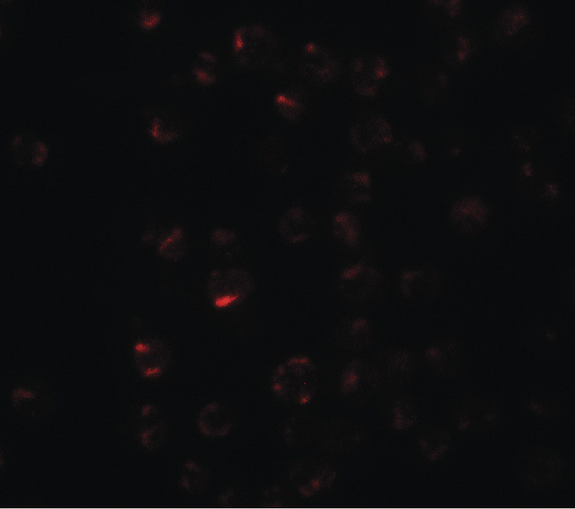 CLEC2A Antibody - Immunofluorescence of CLEC2A in K562 cells with CLEC2A antibody at 20 ug/ml.