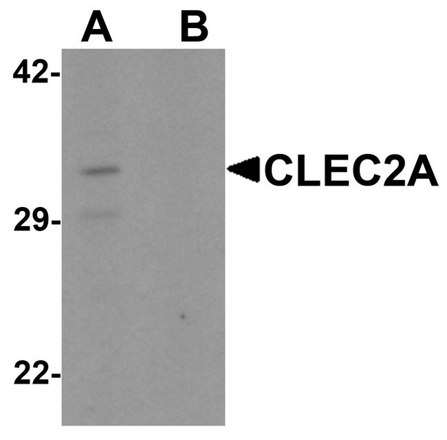 CLEC2A Antibody - Western blot analysis of CLEC2A in K562 cell lysate with CLEC2A antibody at 1 ug/ml in (A) the absence and (B) the presence of blocking peptide.