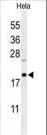 CLEC2B / AICL Antibody - Western blot of CLEC2B Antibody in HeLa cell line lysates (35 ug/lane). CLEC2B (arrow) was detected using the purified antibody.