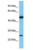 CLEC2D / OCIL / LLT1 Antibody - CLEC2D / OCIL / LLT1 antibody Western Blot of Thymus Tumor. Antibody dilution: 1 ug/ml.  This image was taken for the unconjugated form of this product. Other forms have not been tested.