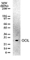 CLEC2D / OCIL / LLT1 Antibody - Western blot of OCIL in mouse spleen cell lysates. Thirty microgram of cell lysates per lane of mini gel was analyzed in Western blotting using antibody.