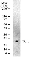 CLEC2D / OCIL / LLT1 Antibody - Western blot of OCIL in mouse spleen cell lysates. Thirty microgram of cell lysates per lane of mini gel was analyzed in Western blotting using antibody.