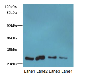 CLEC3A Antibody - Western blot. All lanes: CLEC3A antibody at 0.4 ug/ml. Lane 1: Mouse liver tissue. Lane 2: Mouse kidney tissue. Lane 3: Mouse brain tissue. Lane 4: Mouse lung tissue. Secondary Goat polyclonal to Rabbit IgG at 1:10000 dilution. Predicted band size: 22 kDa. Observed band size: 22 kDa.