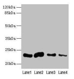 CLEC3A Antibody - Western blot All lanes: CLEC3A antibody at 0.4µg/ml Lane 1: Mouse liver tissue Lane 2: Mouse kidney tissue Lane 3: Mouse brain tissue Lane 4: Mouse lung tissue Secondary Goat polyclonal to rabbit IgG at 1/10000 dilution Predicted band size: 22 kDa Observed band size: 22 kDa