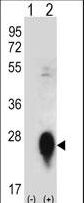 CLEC3B / Tetranectin Antibody - Western blot of CLEC3B (arrow) using rabbit polyclonal CLEC3B Antibody. 293 cell lysates (2 ug/lane) either nontransfected (Lane 1) or transiently transfected (Lane 2) with the CLEC3B gene.