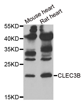 CLEC3B / Tetranectin Antibody - Western blot analysis of extracts of various tissues.
