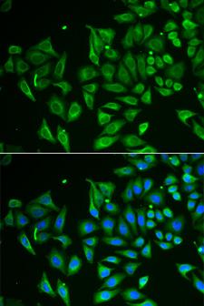 CLEC3B / Tetranectin Antibody - Immunofluorescence analysis of HeLa cells.