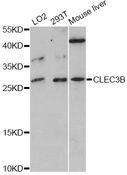 CLEC3B / Tetranectin Antibody - Western blot analysis of extracts of various cell lines, using CLEC3B antibody at 1:3000 dilution. The secondary antibody used was an HRP Goat Anti-Rabbit IgG (H+L) at 1:10000 dilution. Lysates were loaded 25ug per lane and 3% nonfat dry milk in TBST was used for blocking. An ECL Kit was used for detection and the exposure time was 90s.
