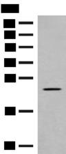 CLEC3B / Tetranectin Antibody - Western blot analysis of Rat heart tissue lysate  using CLEC3B Polyclonal Antibody at dilution of 1:650