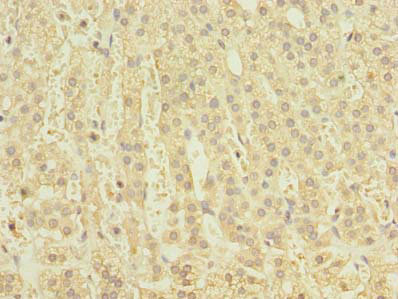 CLEC4C / CD303 / BDCA-2 Antibody - Immunohistochemistry of paraffin-embedded human adrenal gland tissue using CLEC4C Antibody at dilution of 1:100