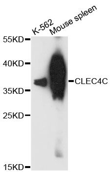 CLEC4C / CD303 / BDCA-2 Antibody - Western blot analysis of extracts of various cell lines, using CLEC4C antibody at 1:3000 dilution. The secondary antibody used was an HRP Goat Anti-Rabbit IgG (H+L) at 1:10000 dilution. Lysates were loaded 25ug per lane and 3% nonfat dry milk in TBST was used for blocking. An ECL Kit was used for detection and the exposure time was 10s.