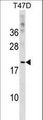 CLEC4D / MCL Antibody - CLEC4D Antibody western blot of T47D cell line lysates (35 ug/lane). The CLEC4D antibody detected the CLEC4D protein (arrow).