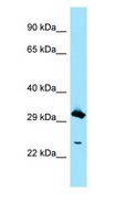 CLEC4D / MCL Antibody - CLEC4D / MCL antibody Western Blot of PANC1.  This image was taken for the unconjugated form of this product. Other forms have not been tested.