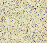 CLEC4D / MCL Antibody - Immunohistochemistry of paraffin-embedded human spleen tissue using CLEC4D Antibody at dilution of 1:100