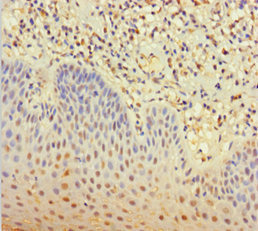 CLEC4D / MCL Antibody - Immunohistochemistry of paraffin-embedded human tonsil tissue using CLEC4D Antibody at dilution of 1:100