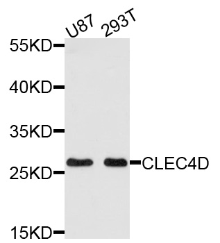 CLEC4D / MCL Antibody - Western blot analysis of extracts of various cells.
