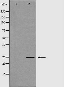 CLEC4D / MCL Antibody - Western blot analysis of extracts of 293T cells using CLEC4D antibody. The lane on the left is treated with the antigen-specific peptide.