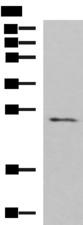 CLEC4D / MCL Antibody - Western blot analysis of Human fetal brain tissue lysate  using CLEC4D Polyclonal Antibody at dilution of 1:700