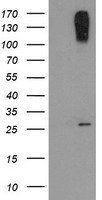 CLEC4E / MINCLE Antibody - HEK293T cells were transfected with the pCMV6-ENTRY control (Left lane) or pCMV6-ENTRY CLEC4E (Right lane) cDNA for 48 hrs and lysed. Equivalent amounts of cell lysates (5 ug per lane) were separated by SDS-PAGE and immunoblotted with anti-CLEC4E.