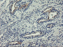 CLEC4E / MINCLE Antibody - IHC of paraffin-embedded Human Ovary tissue using anti-CLEC4E mouse monoclonal antibody.