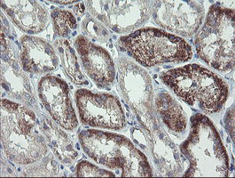 CLEC4E / MINCLE Antibody - IHC of paraffin-embedded Human Kidney tissue using anti-CLEC4E mouse monoclonal antibody.