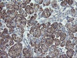 CLEC4E / MINCLE Antibody - IHC of paraffin-embedded Human pancreas tissue using anti-CLEC4E mouse monoclonal antibody.