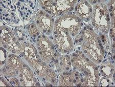 CLEC4E / MINCLE Antibody - IHC of paraffin-embedded Human Kidney tissue using anti-CLEC4E mouse monoclonal antibody. (Heat-induced epitope retrieval by 10mM citric buffer, pH6.0, 100C for 10min).