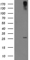CLEC4E / MINCLE Antibody - HEK293T cells were transfected with the pCMV6-ENTRY control (Left lane) or pCMV6-ENTRY CLEC4E (Right lane) cDNA for 48 hrs and lysed. Equivalent amounts of cell lysates (5 ug per lane) were separated by SDS-PAGE and immunoblotted with anti-CLEC4E.