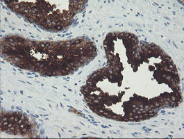 CLEC4E / MINCLE Antibody - IHC of paraffin-embedded Human prostate tissue using anti-CLEC4E mouse monoclonal antibody. (Heat-induced epitope retrieval by 10mM citric buffer, pH6.0, 100C for 10min).