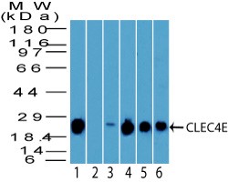CLEC4E / MINCLE Antibody - Western Blot: CLEC4E Antibody - analysis of CLEC4E using CLEC4E antibody. Human spleen cell lysate in the 1) absence and 2) presence of immunizing peptide, 3) mouse spleen, 4) rat spleen, 5) Ramos and 6) THP1 cell lysate probed with 2 ug/ml of CLEC4E antibody. [Character a1]s goat anti-rabbit Ig HRP secondary antibody and PicoTect ECL substrate solution were used for this test.