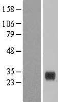CLEC4E / MINCLE Protein - Western validation with an anti-DDK antibody * L: Control HEK293 lysate R: Over-expression lysate