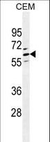 CLEC4F Antibody - CLEC4F Antibody western blot of CEM cell line lysates (35 ug/lane). The CLEC4F antibody detected the CLEC4F protein (arrow).
